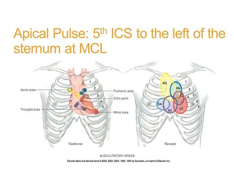 ApicalPulse-5thICStotheleftofthesternumatMCL.jpg (960×720) | Apical ...