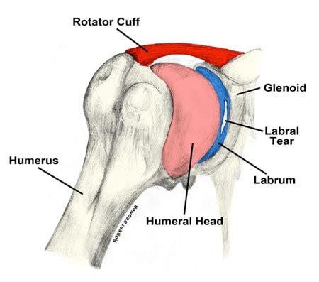 Shoulder Labral Tear Surgery Pros and Cons: Hidden Shoulder Instability - Regenexx®