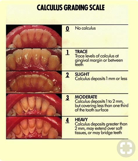 Pin by Lisa Arredondo on Dental Ed | Dental, Dental hygenist, Dental hygienist