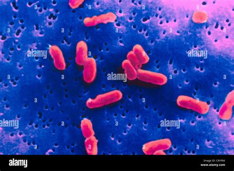 SHIGELLA SONNEI Stock Photo: 49162462 - Alamy