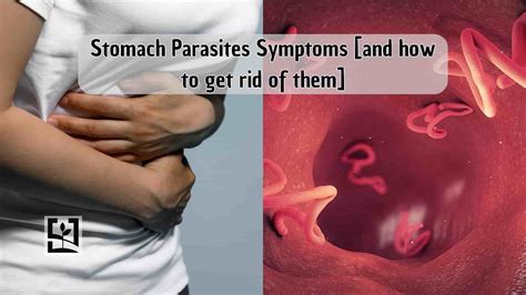 Stomach Parasites Symptoms [and how to get rid of them] - My Blog