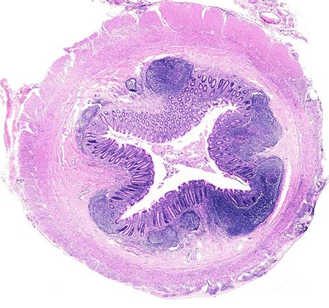 Vermiform Appendix Histology