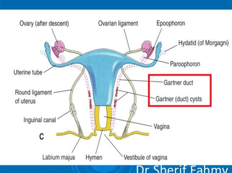 Gartner Duct Cyst: What Is It, Symptoms, And More Osmosis, 51% OFF