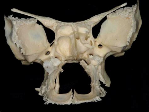 Sphenoid and Palatine Bones | Neuroanatomy | The Neurosurgical Atlas