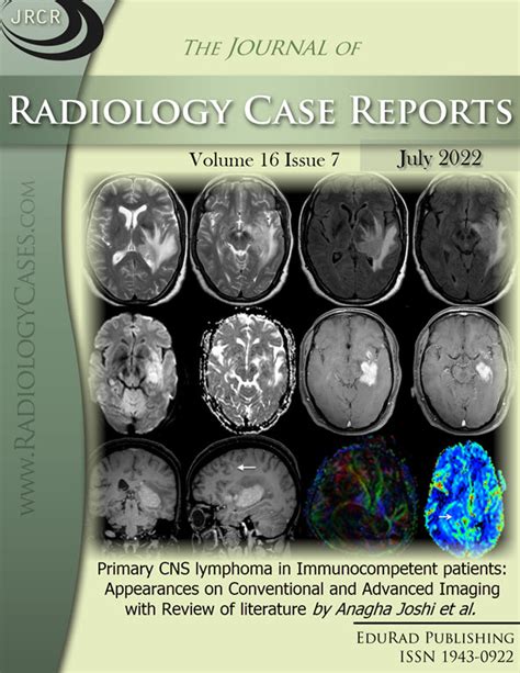 Journal of Radiology Case Reports