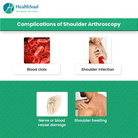 Shoulder Arthroscopy: Learn more about the procedure – Healthsoul