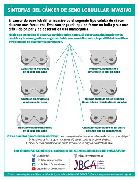 Sintomas-Del-Cancer-De-Seno-Lobulillar-Invasivo-11-21 - The Lobular Breast Cancer Alliance