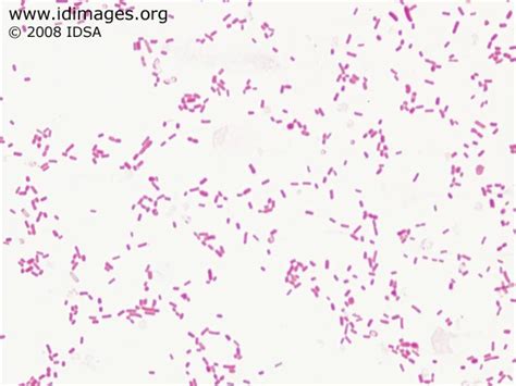 Infectious Disease Images - eMicrobes Digital Library - Images