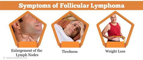 Follicular Lymphoma - Causes, Symptoms, Diagnosis, Treatment and Prevention