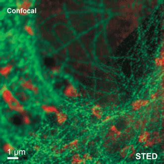 STED Microscopy Made Easy | Features | Dec 2014 | Photonics Spectra