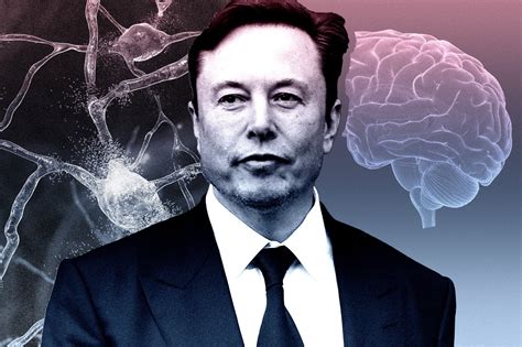 Elon Musk wants to implant millions of Neuralink brain chip as new powers unveiled | The Independent