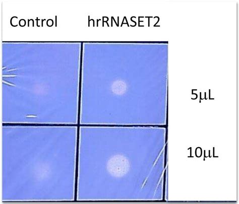 RNase activity assay. The RNase activity of purified hrRNASET2 was... | Download Scientific Diagram