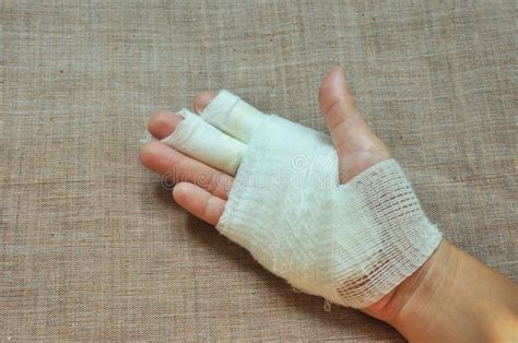 Injury hand with bandage stock image. Image of recovery - 32328629