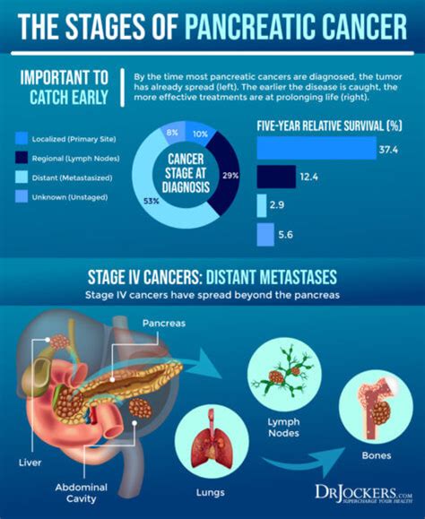 Pancreatic Cancer: Symptoms, Causes and Support Strategies