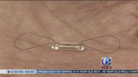 CardioMEMS device helps to prevent heart failure - 6abc Philadelphia