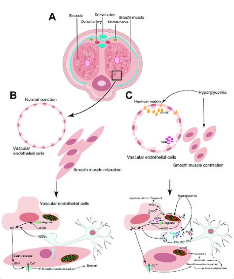 Schematic of the mechanisms involved in the etiology of diabetic... | Download Scientific Diagram