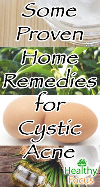 12 Proven Home Remedies for Cystic Acne - Healthy Focus