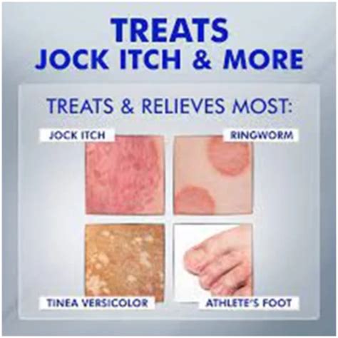 Jock Itch (Tinea Cruris) In Kids: Causes, Remedies, 40% OFF