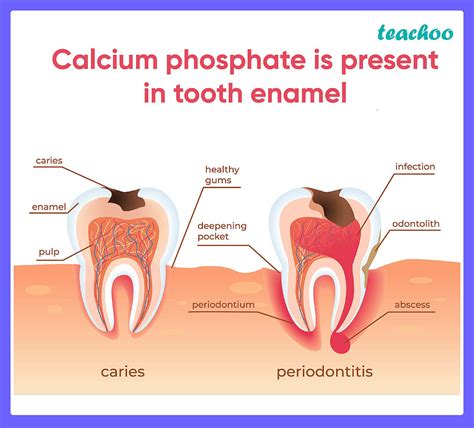 [MCQ] Calcium phosphate is present in tooth enamel. Its nature is