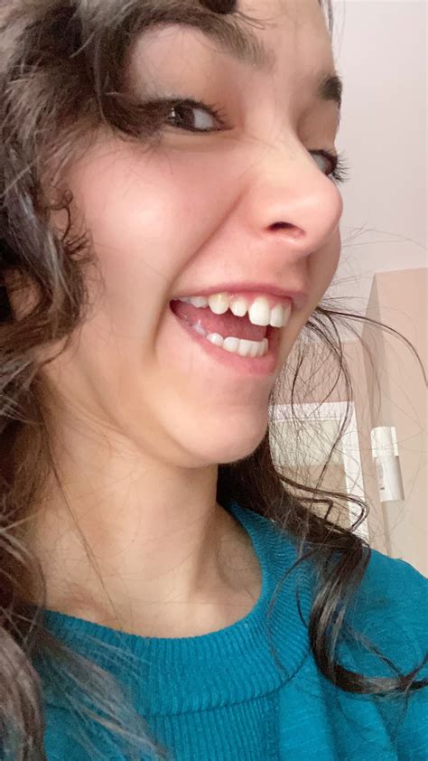 ASMR Glow 🐍 on Twitter: "For the lolz when I lost my tooth and sent ...