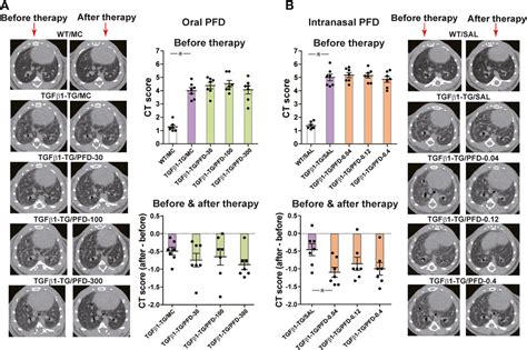 Frontiers | Low-Dose of Intrapulmonary Pirfenidone Improves Human ...