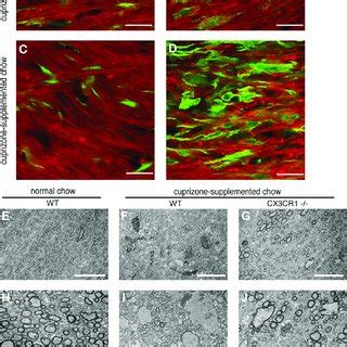 Myelin staining and electron microscopy reveal the presence of ...