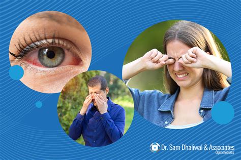 Protecting your eyes from seasonal allergies - Dr. Sam Dhaliwal & Associates