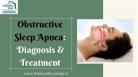 Obstructive Sleep Apnea: Diagnosis and Treatment