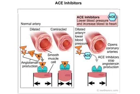 ACE Inhibitors: List of Names, Side Effects & Dosage - Dr. Linex