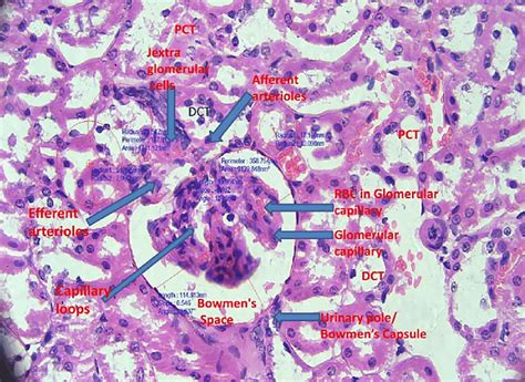 Glomerular integrity based on histological architecture (H& 40×). It ...