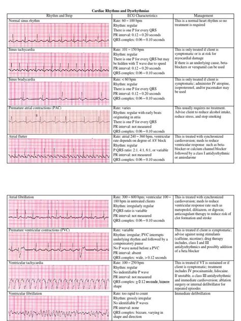 Free Printable Ekg Interpretation Cheat Sheet