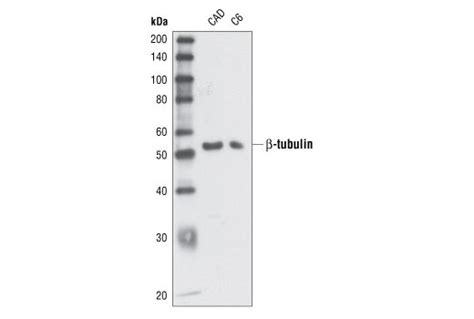 β-Tubulin Antibody | Cell Signaling Technology