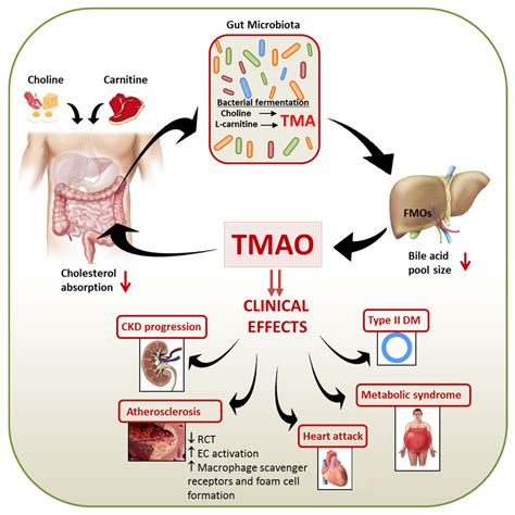 Toxins | Free Full-Text | Trimethylamine N-Oxide: The Good, the Bad and the Unknown