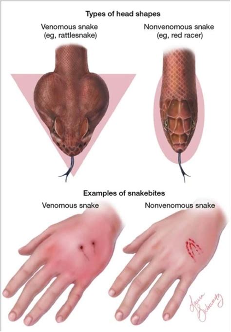 Your Great Outdoors: Snake Basics—Poisonous vs. Non-Poisonous, how to ...