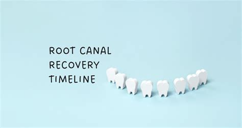 Root Canal Recovery Timeline - Web Guest Posting