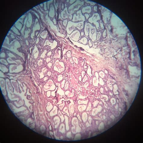 Stratified Cuboidal Epithelium - Definition and Function | Biology Dictionary