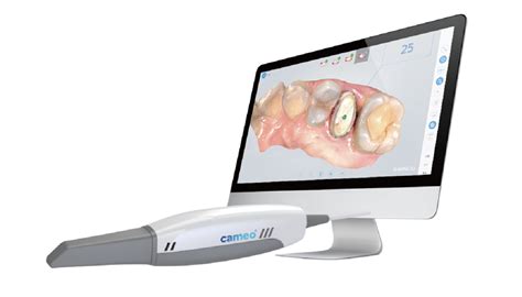 Cameo IntraOral Scanner - Whitesmile Clear Aligner - The Clear and ...