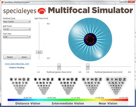 Toric Multifocal Contact Lens Design: Case Study