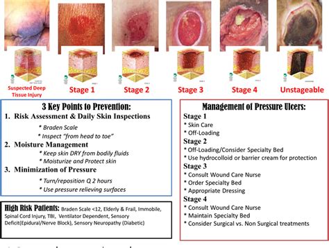 Figure 4 from Development of an evidence-based pressure ulcer program at the National Naval ...