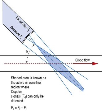 Physical principles of Doppler ultrasound | Radiology Key