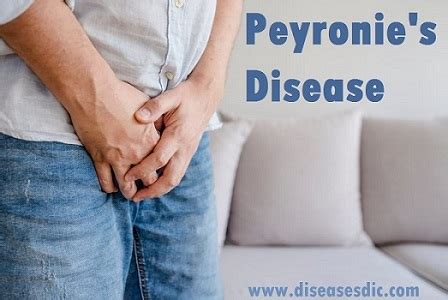 Peyronie's disease – Causes, Stages, Symptoms and Treatment