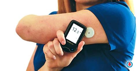 Revolutionary Diabetes System Which Checks Glucose Without a Finger Prick - Diabetes Health Page