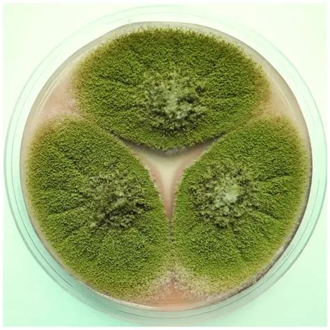 Aspergillus flavus - Definition, Structure, Characteristics, Habitat - Biology Notes Online