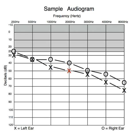 Audiology - Dr. Sean Tubbs