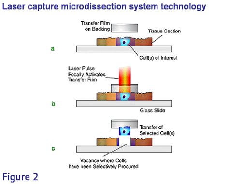 Laser capture microdissection system technology – In the top panel (a)... | Download Scientific ...