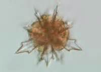 Zooplankton analysis by microscopy and molecular biology