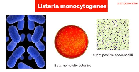 Listeria monocytogenes: Properties, Pathogenesis, Lab Diagnosis ...