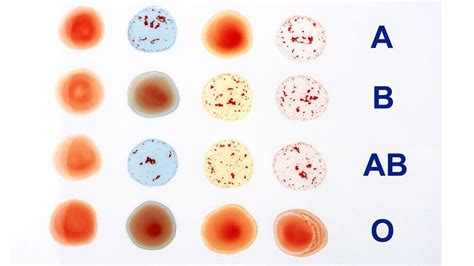 Why do we have blood types? - BBC Future