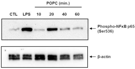 Membranes | Free Full-Text | Phosphatidylcholine Liposomes Reprogram ...