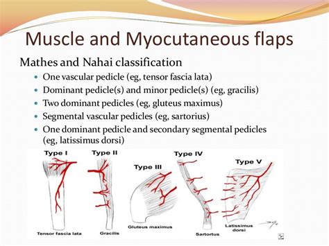 Types Of Flaps Plastic Surgery - Design Talk